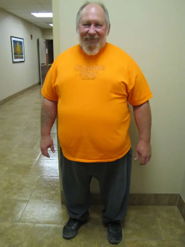 Lyle before bariatric surgery